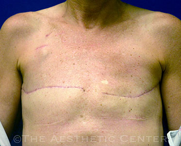 01-Preop1 01-Preop1